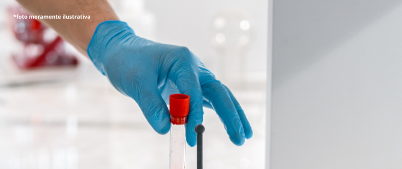 Alerj aprova inclusão do exame de Vitamina D na rede estadual