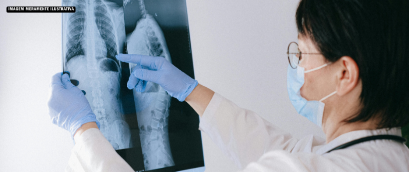 Profissionais de saúde da rede municipal participam de ação de capacitação no combate à tuberculose