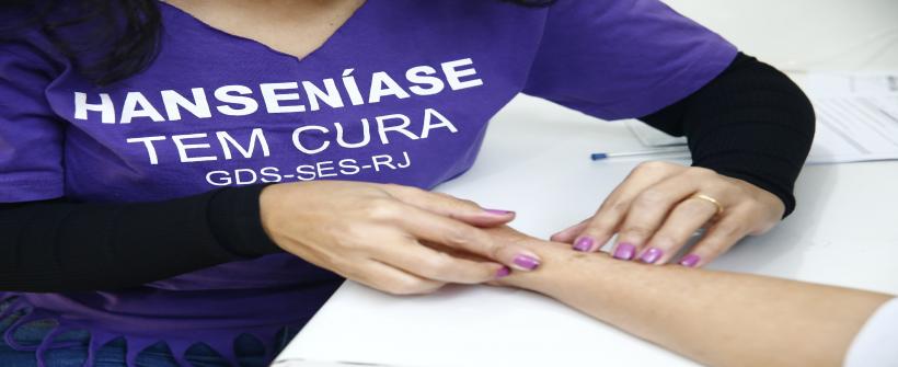 RJ sedia Conferência Nacional de Alto Nível em Hanseníase 2026 no Rio de Janeiro