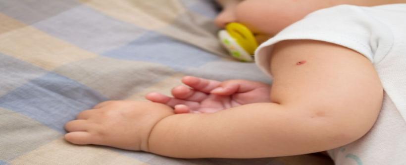 Dia da BCG: vacina é a proteção mais eficaz contra a tuberculose