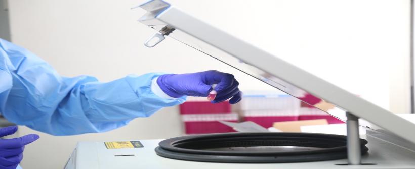 SES-RJ orienta a população e esclarece eventuais dúvidas sobre a doença