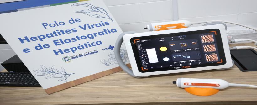 Governo do Estado destina ao IASERJ equipamento que substitui biópsia hepática e permite avaliar fibrose e gordura no fígado de forma rápida e indolor