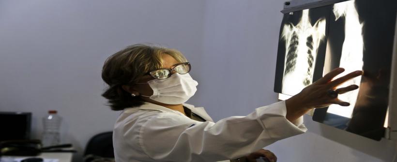  Secretaria de Estado de Saúde lança Painel de Tuberculose com o mapa da doença no Estado do Rio