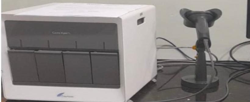 Máquinas de teste rápido molecular facilitam diagnóstico de tuberculose no estado