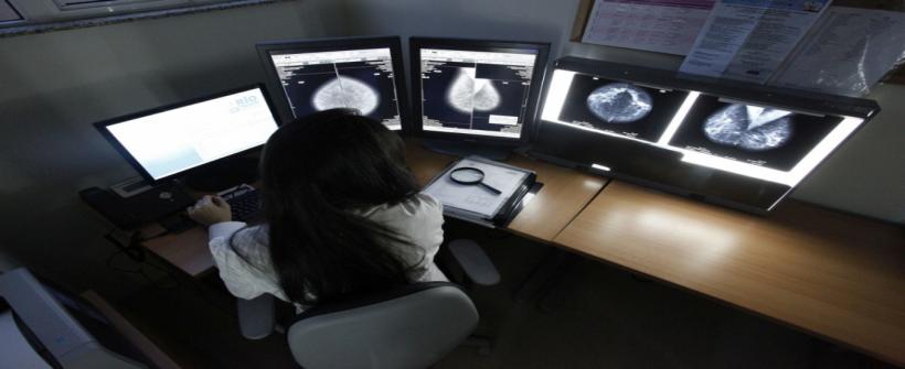 Rio Imagem oferece mamografia gratuita em todo o mês de outubro