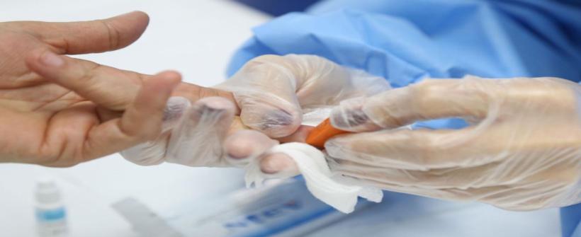 SES faz roda de conversa sobre hepatite viral e promove testagem em servidores