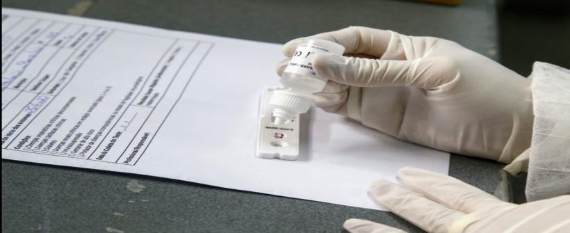 SES inicia pesquisa sobre imunidade da população para coronavírus