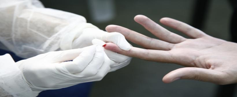 Secretaria de Estado de Saúde (SES-RJ) amplia a oferta de testes rápidos para diagnóstico precoce de Hepatites Virais