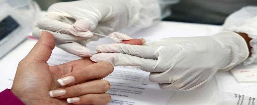 Secretaria de Estado de Saúde promove testagem rápida de HIV nesta segunda-feira