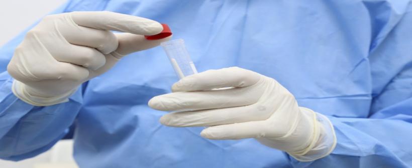 Secretaria de Saúde amplia capacidade de coleta para o diagnóstico de Monkeypox no estado