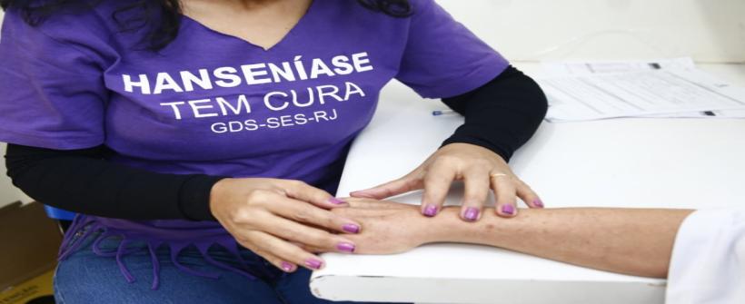 Seminário online reúne especialistas sobre hanseníase para discutir estratégias durante a pandemia de COVID-19