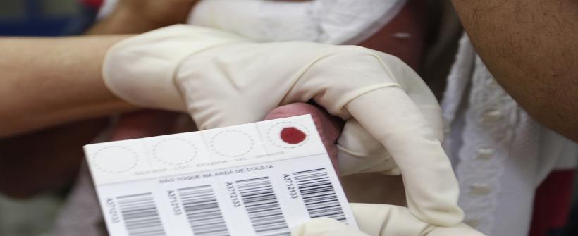 Atualmente, o Estado do Rio de Janeiro rastreia 54 doenças raras pela rede pública de saúde