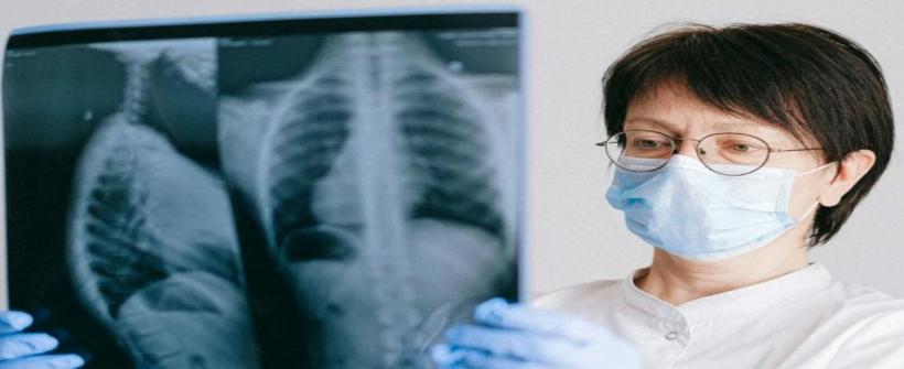 Secretaria de Estado de Saúde acelera diagnóstico de tuberculose e realiza mais de 4 mil testes rápidos moleculares no estado